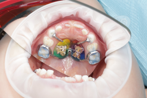 Аппарат в день установки