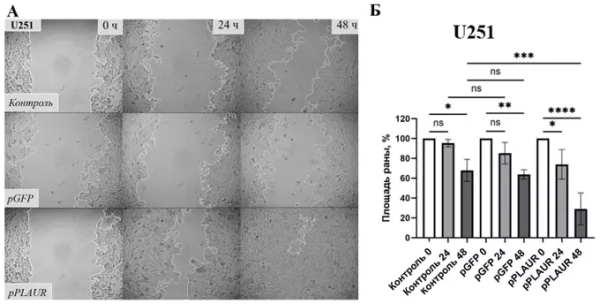 Найдена причина агрессивности опухолей головного&hellip;