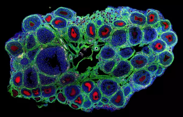 Побочный эффект: антидепрессант «ударил» по яичникам мышей «в обход» мозга 1 f430461a54074de76ba6b246868e5d1b.jpg
