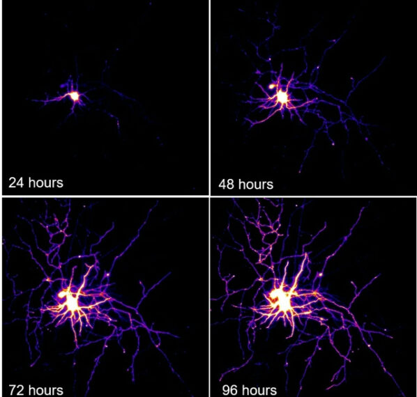 Мотонейроны человека: как они работают&hellip;