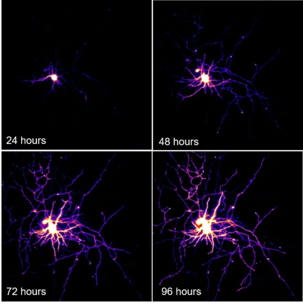 Мотонейроны человека: как они работают и почему уязвимы&hellip;