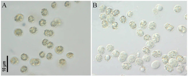 Физиологи нашли в двух столичных прудах токсичные цианобактерии 2 Физиологи нашли в двух столичных прудах токсичные цианобактерии