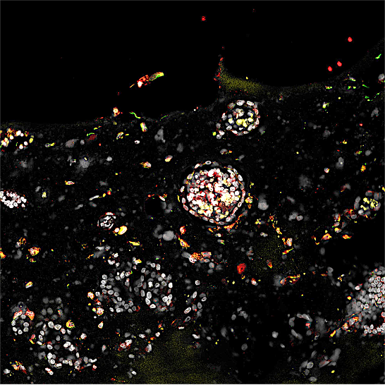 два эмбриона развиваются в плацентарной ткани