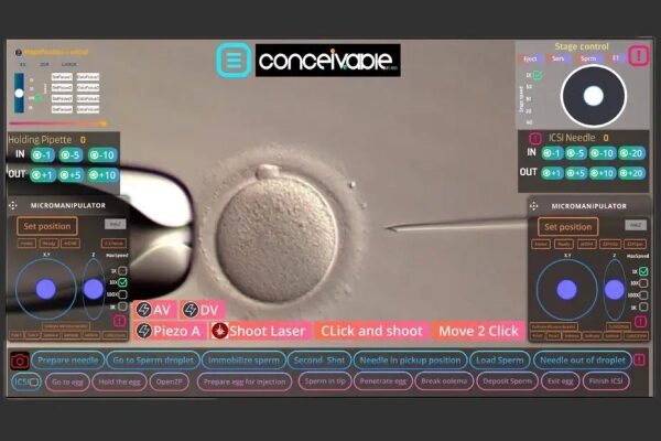 Что видит медицинский работник, наблюдая за процедурой через прямую трансляцию?