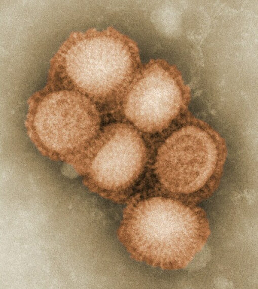 Вирус H1N1 под микроскопом, изображение частиц гриппа с электронной микроскопией.