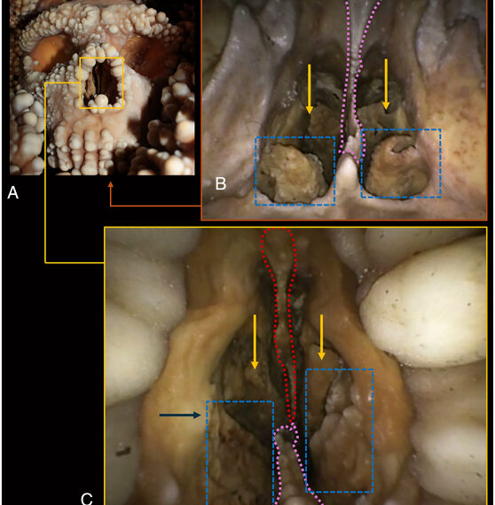 Анатомия осьминога: крупный план структур и деталей.