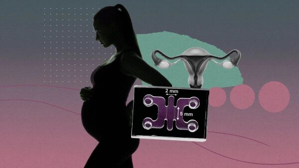 Беременная женщина, изображение матки и медицинского устройства на фоне.