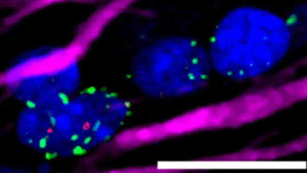 Флуоресцентное микроскопическое изображение клеток с синими ядрами, зелёными и фиолетовыми элементами.