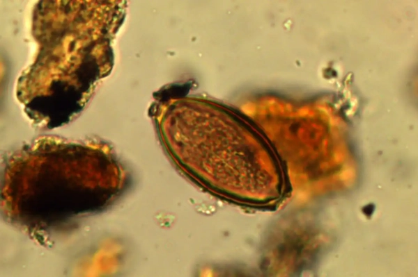 У римских солдат, защищавших Адрианов вал, были кишечные паразиты. 3 9f4e0308101abc9fa5c715e3075b6217