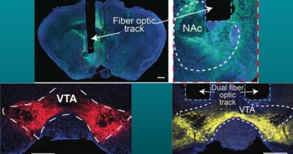 Микроскопическое изображение мозга с оптическими волокнами, отмеченными яркими цветами.