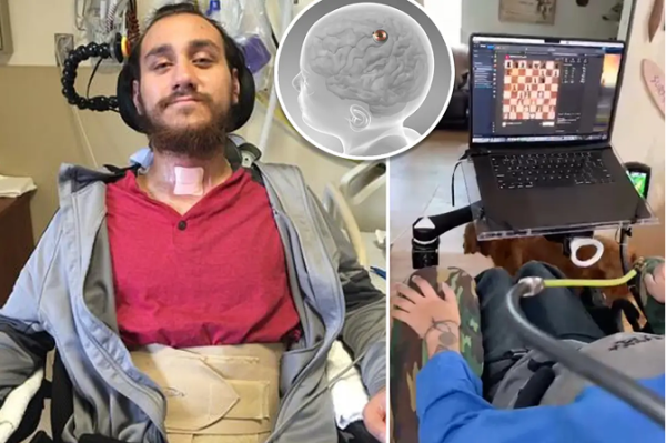 Человек управляет компьютером с помощью интерфейса мозг-компьютер, играя в шахматы.