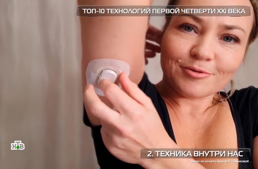 Человек применяет медицинский датчик на руку, надпись: "Техника внутри нас".