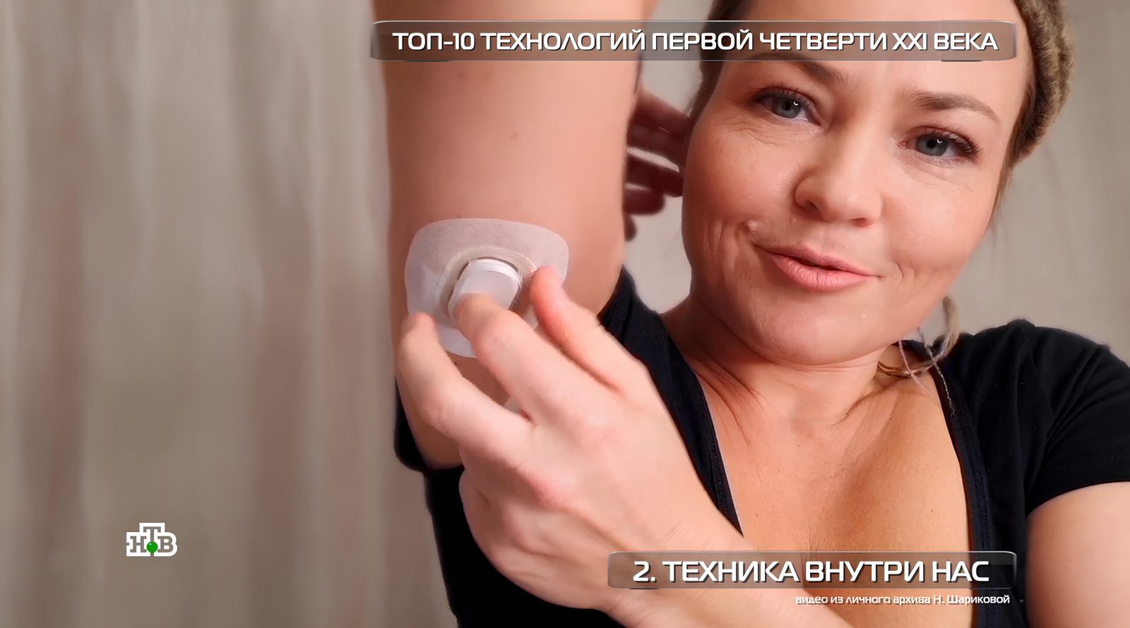 Чипирование всё ближе: как пугающая технология помогает неизлечимо больным 2 Человек применяет медицинский датчик на руку, надпись: "Техника внутри нас".