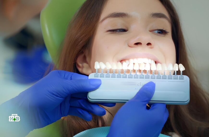 Голливудская улыбка своими руками: проверка&hellip;