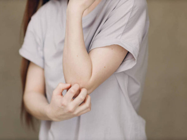 Женщина в белой футболке чешет локоть, крупный план.