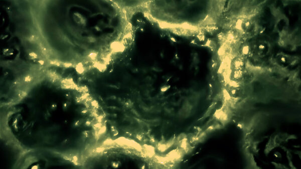 Абстрактное фоновое изображение с зелеными и черными узорами, напоминающими микроскопический вид.