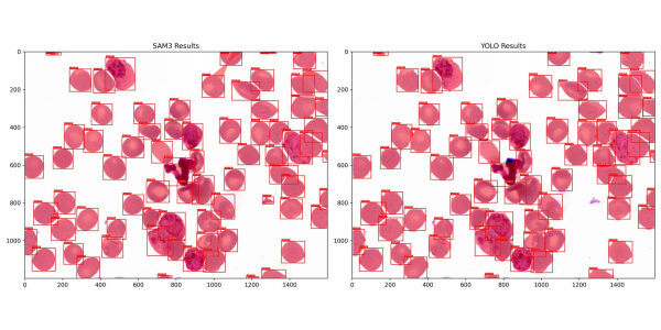 14cfd5646bf035a02da1fe28a54b8473