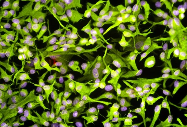 Сеть зеленых клеток с сиреневыми ядрами.