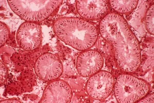 Менструальные прокладки могут помочь женщинам понять, как меняется их фертильность. 3 Микрофотография среза семенных канальчиков — места образования сперматозоидов.