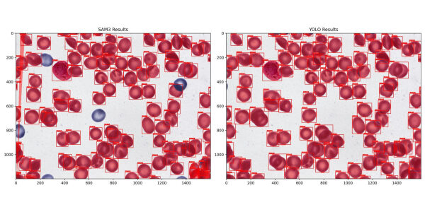 Сравнение результатов распознавания кровяных клеток с помощью моделей SAM3 и YOLO.