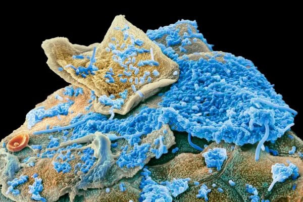 Микроскопическое изображение бактерий и микроорганизмов на поверхности кожи.