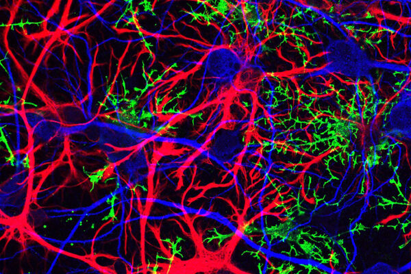 Увеличенное изображение различных клеток головного мозга, окрашенных в разные цвета.