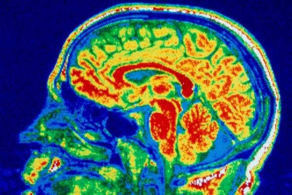 2026 год прольет свет на то, помогает ли малоизвестный препарат при аутизме. 4 85bb8a26189b5e55c30e779b56a02025
