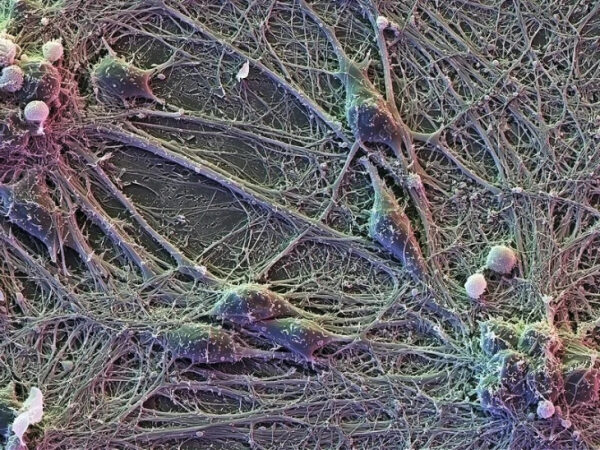 Сканирующая микрофотография нейронов мозга с сетью отростков и клеток.