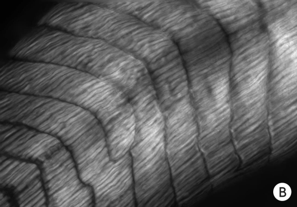 Фотография развития мышц у эмбрионов головастиков без мозга.