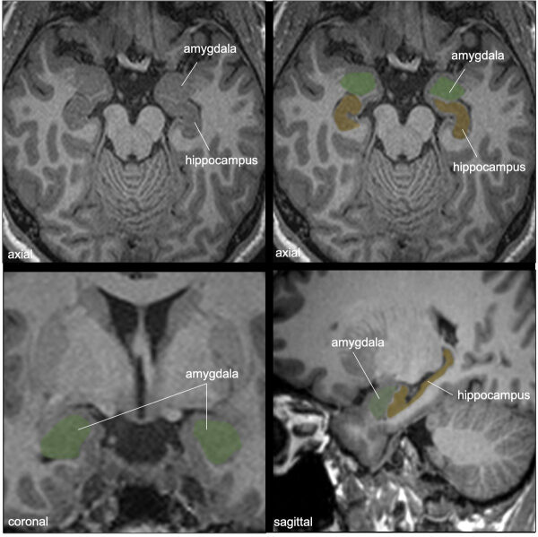 adff19e8f4a60c440e516640ec2354e3