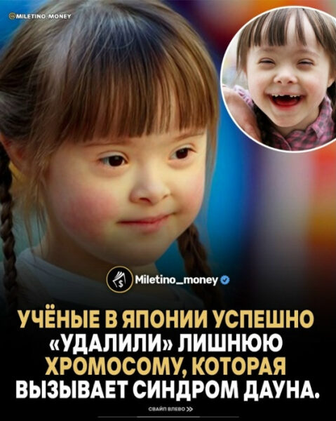 Учёные из Японии совершили настоящий прорыв: впервые в истории они удалили лишнюю хромосому, вызывающую синдром Дауна — прямо в человеческих клетках 2 Девочка с синдромом Дауна и заголовок о научном достижении из Японии.