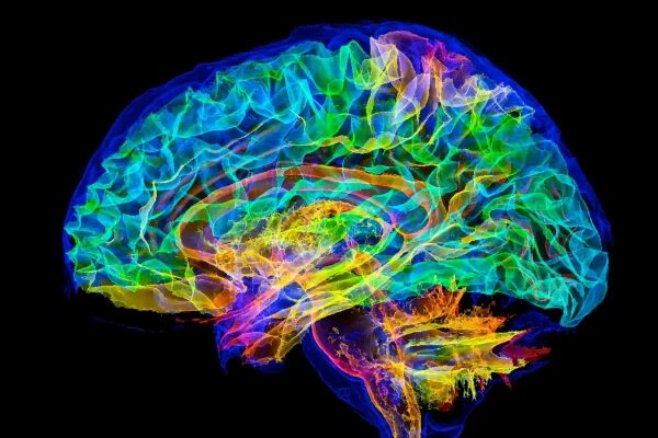 Радужное изображение мозга, иллюстрирующее нейронные связи и активность.