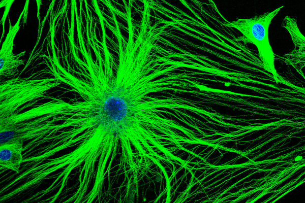 Клетки под микроскопом с зелеными отростками, синие ядра. Научная иллюстрация биологии.