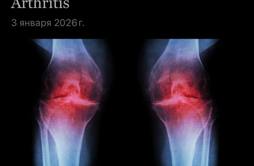Рентген коленей, инъекции против старения восстанавливают хрящи и предотвращают артрит.
