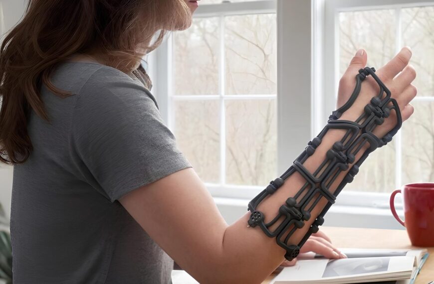 Женщина с 3D-печатной ортопедической шиной на руке за столом, рядом красная кружка.