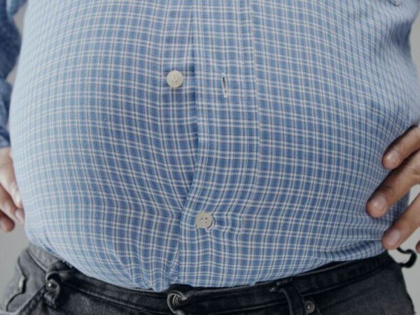 Мужчина в рубашке в клетку с распахнутыми пуговицами, руки на боках.