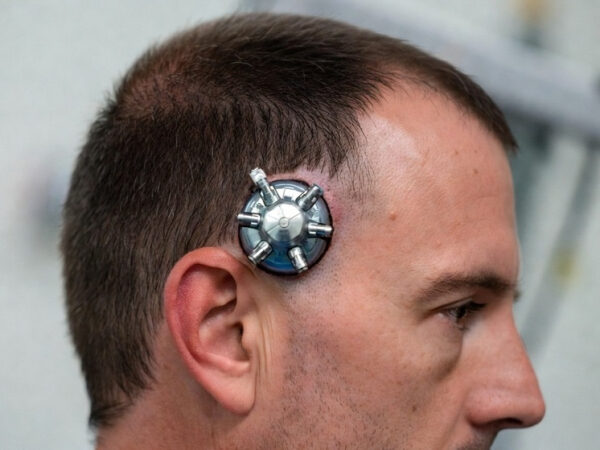 Задняя часть головы человека с короткими волосами и очками.