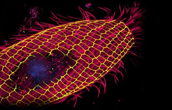 Флуоресцентная микрофотография, демонстрирующая сетчатую клеточную кору клетки Vorticella, окрашенную в желтый и пурпурный цвета.