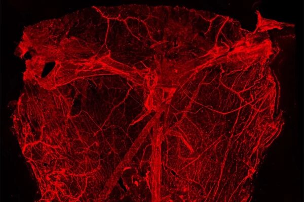 Изображение нервной системы плода мыши в ярко-красных тонах.