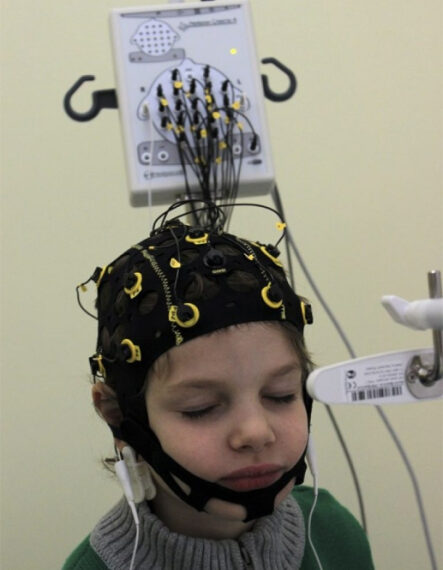 Человек с энцефалографической шапкой и проводами для мониторинга активности мозга.