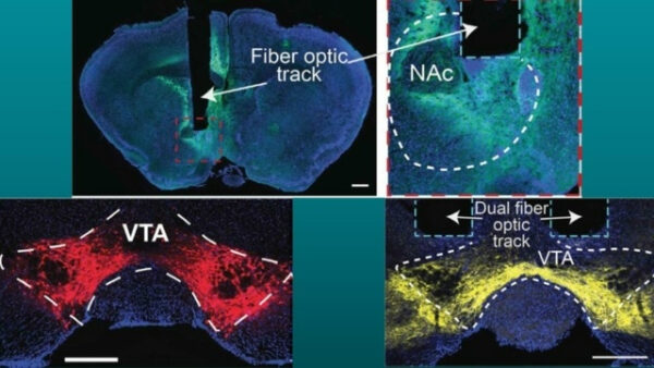 Оптические волокна в мозге: структуры VTA и NAc, картирование нейронных путей.