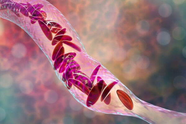 e29c8ff989f77aaf6b174b9176aa7012