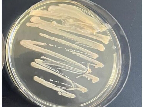 Петри с культурами бактерий на питательной среде в лаборатории.