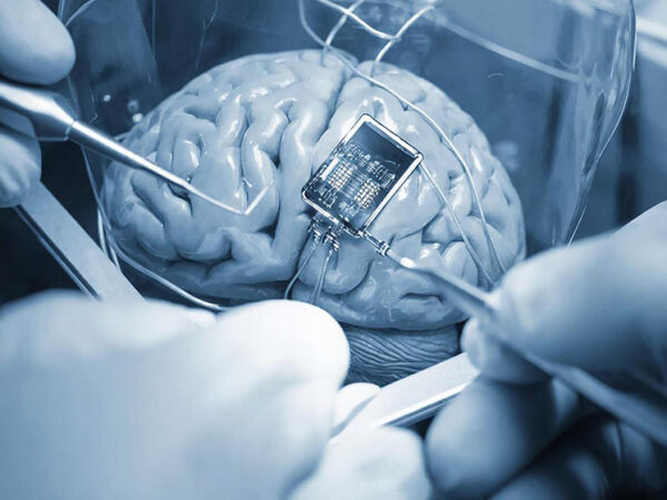 Операция по вживлению чипа в мозг с использованием хирургических инструментов.