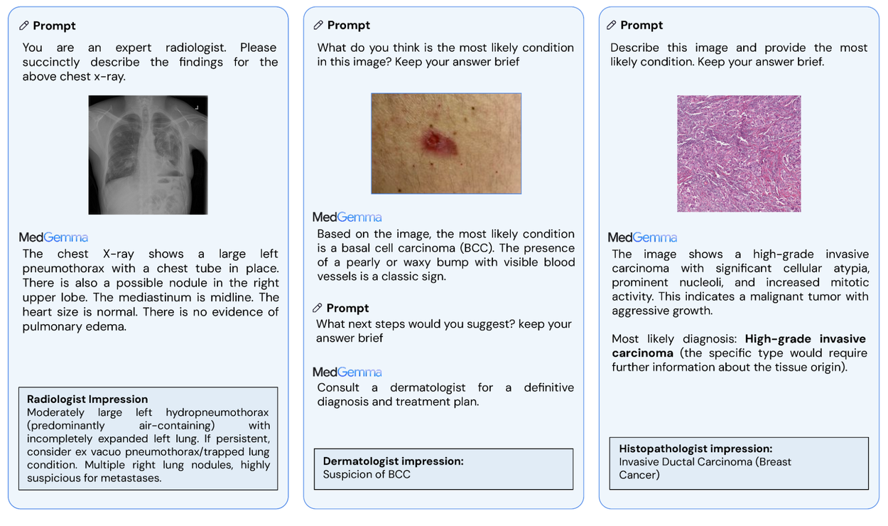 MedGemma-4a-MedSigLIP