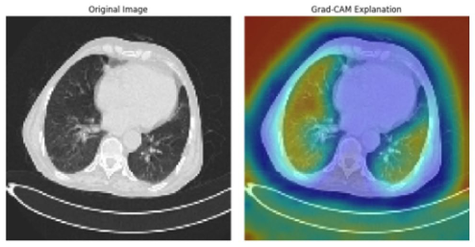 1d8eb0d540d4927626a95fef649c4292