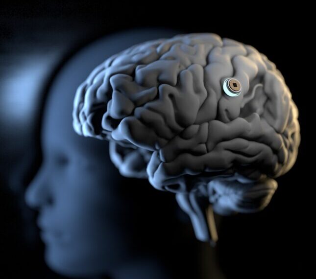 Изображение человеческого мозга с нейроинтерфейсом на тёмном фоне.