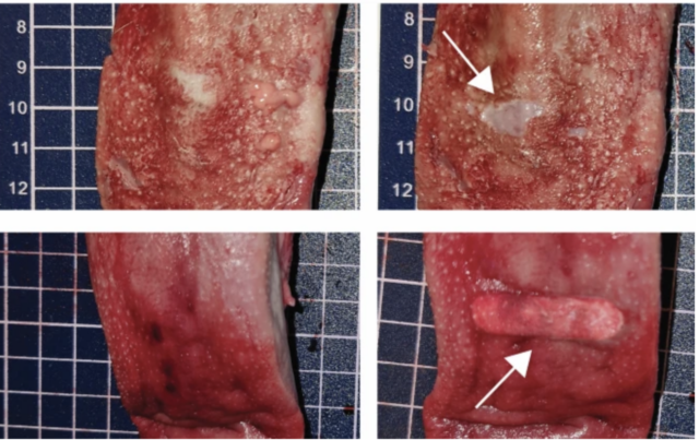 Пример повреждения тканей языка после отслоения