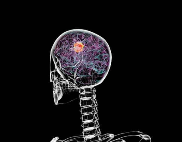 Скелет головы с подсвеченными нейронными связями мозга на черном фоне.