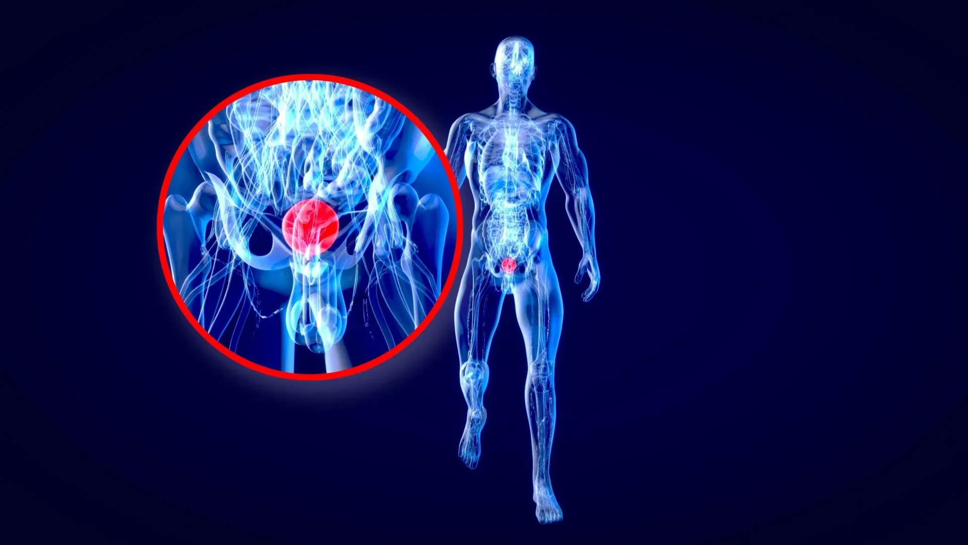 Ученые из Стэнфорда утверждают, что дальтонизм может скрывать смертельно опасное заболевание — рак мочевого пузыря. 3 Медицинская иллюстрация мужской анатомии с увеличением простаты.